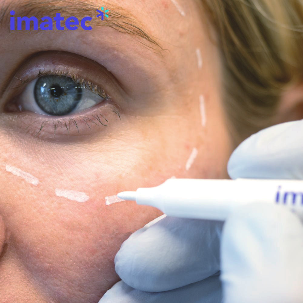 Marktec Skin Markers - White, Green or Red (10 Pack) by Imatec Medical