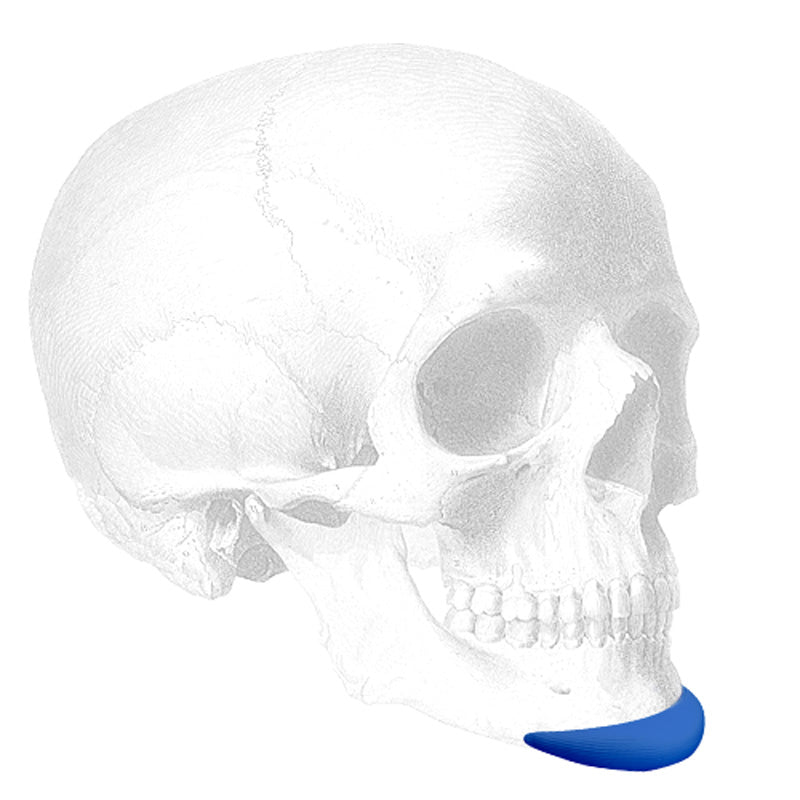 Implantech ePTFE Extended Chin Implant