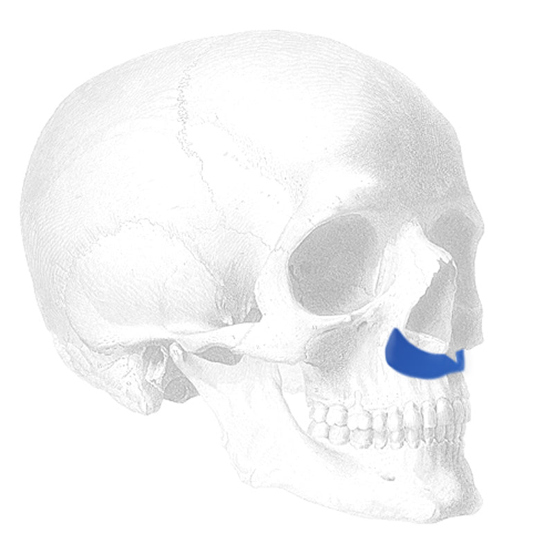 Implantech ePTFE Premaxillary Implant