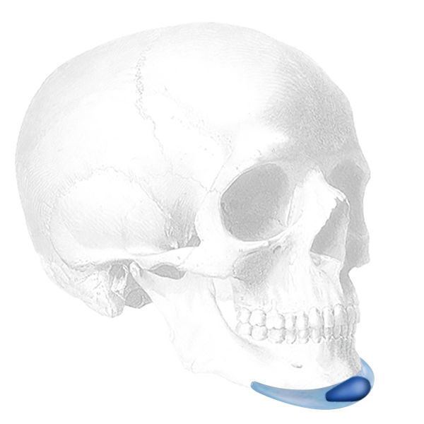 Implantech Glasgold Wafer™ for the EAC or TEAC Implant