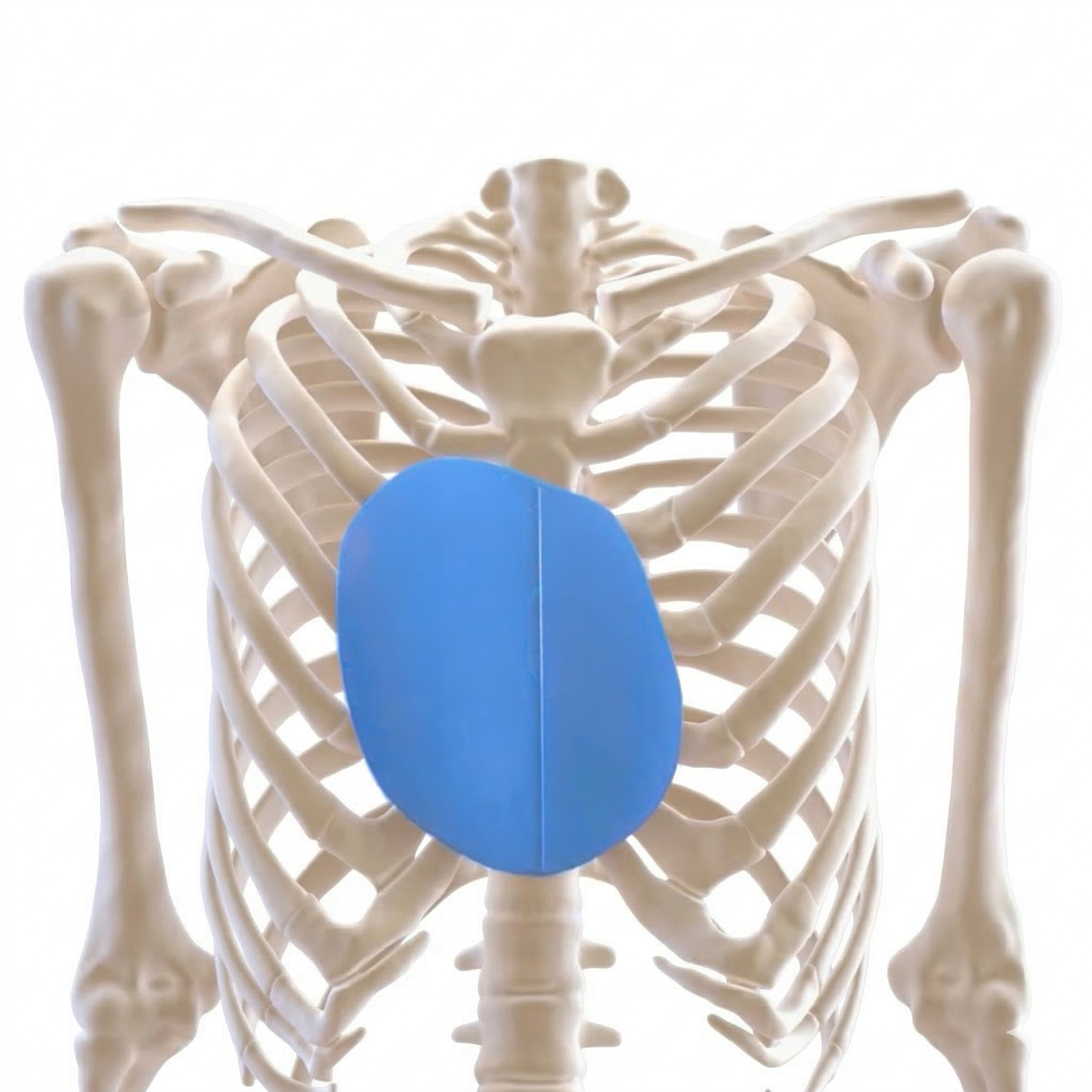 3D Custom Made Implants For Pectus Excavatum (and Poland Syndrome) by AnatomikModeling