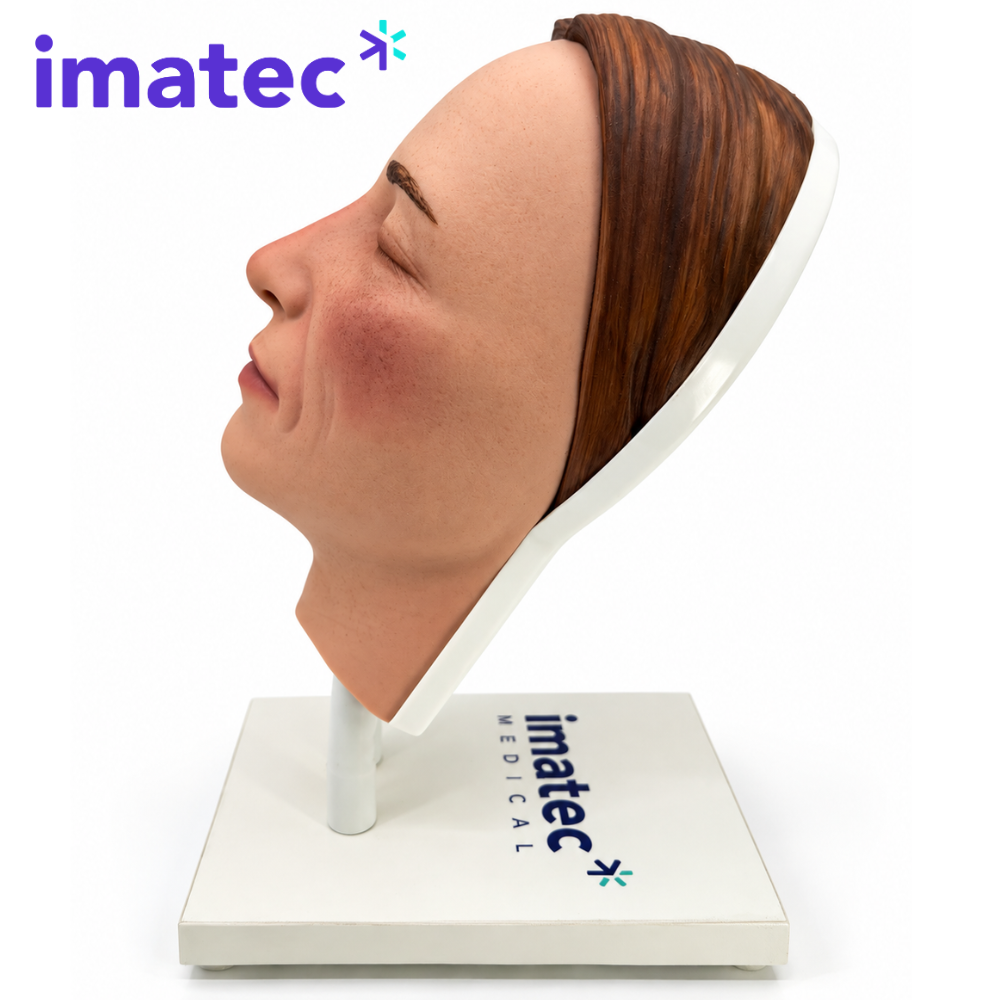 Facial Injection Training Head by Imatec Medical