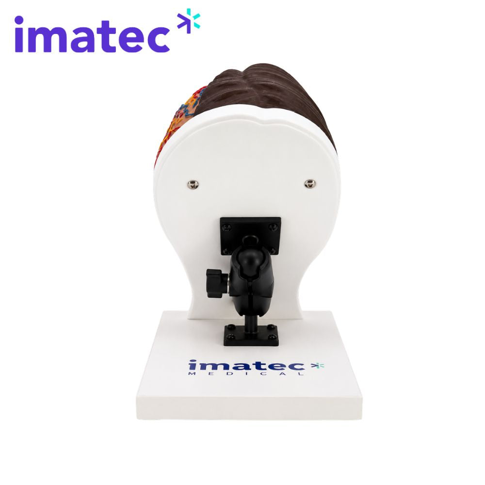 Half Anatomy Facial Injection Head by Imatec Medical