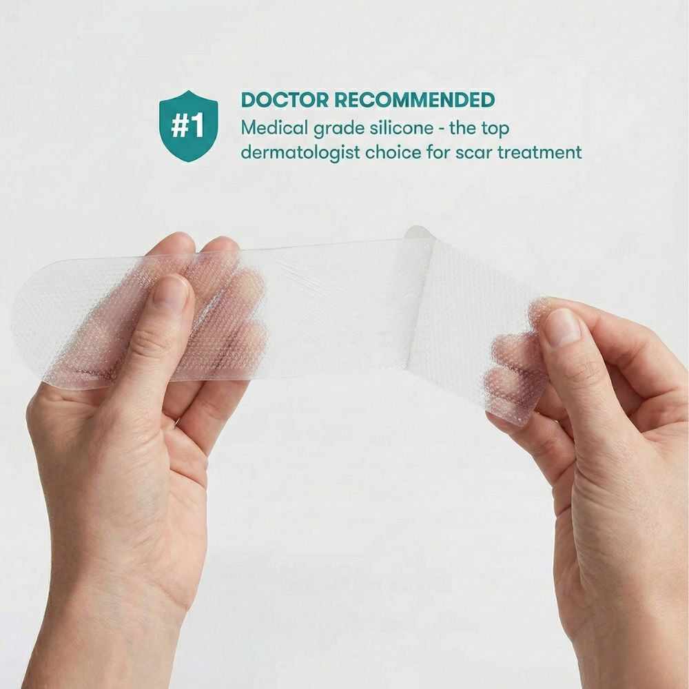 Restore Silicone Scar Sheet (150mmx15mm) by Imatec Medical