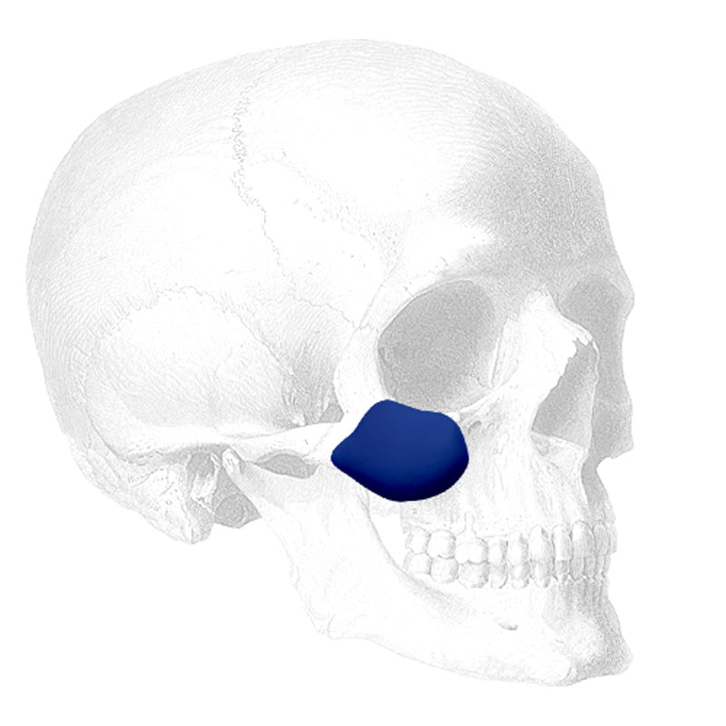 Implantech ePTFE Midfacial Implant