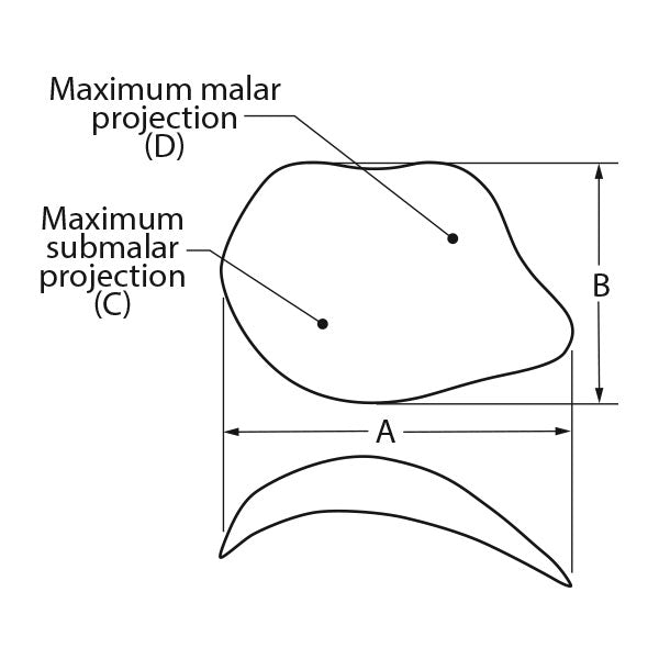 Implantech ePTFE Midfacial Implant