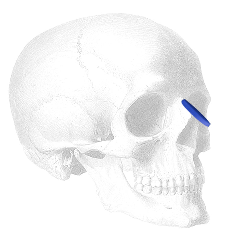 Implantech ePTFE Nasal Dorsum (Pointed) Implant