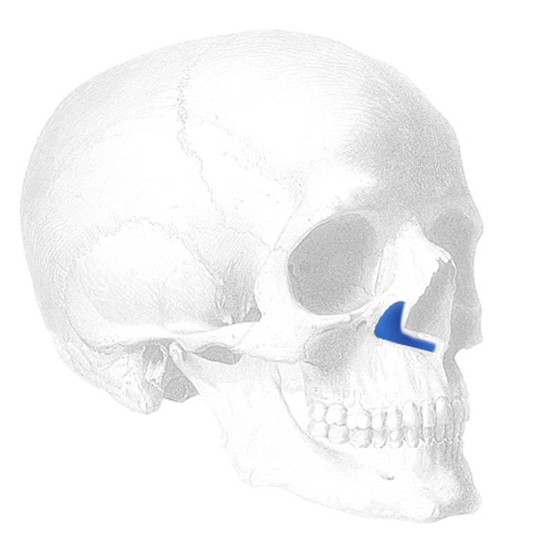 Implantech ePTFE Paranasal Implant