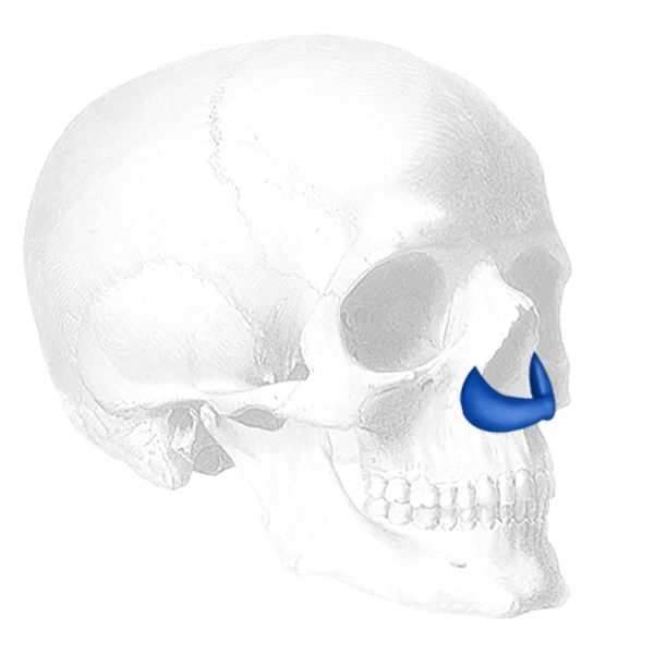 Implantech Peri-Pyriform™ Nasal Implant