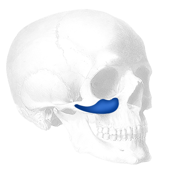 Implantech Binder Submalar® Facial Implant (Sold in Pairs)