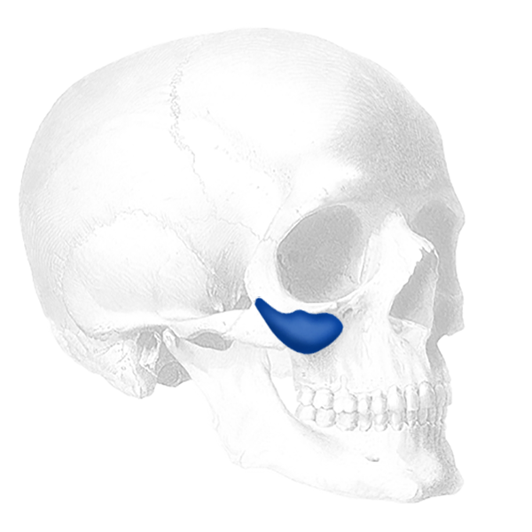 Implantech Binder Submalar® Style II Facial Implant (Sold in Pairs)