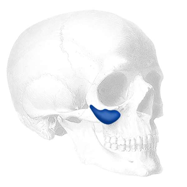 Implantech ePTFE-Coated Binder Submalar® Style II Facial Implant (Sold in Pairs)