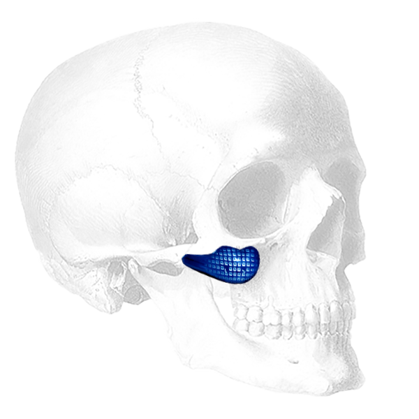 Implantech Conform Binder Submalar® Facial Implant (Sold in Pairs)