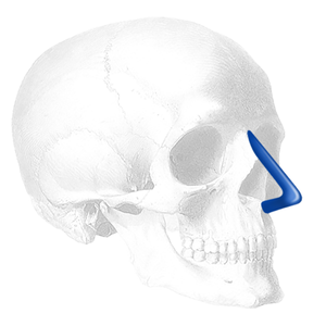 Implantech Dorsal Columella Nasal Implant