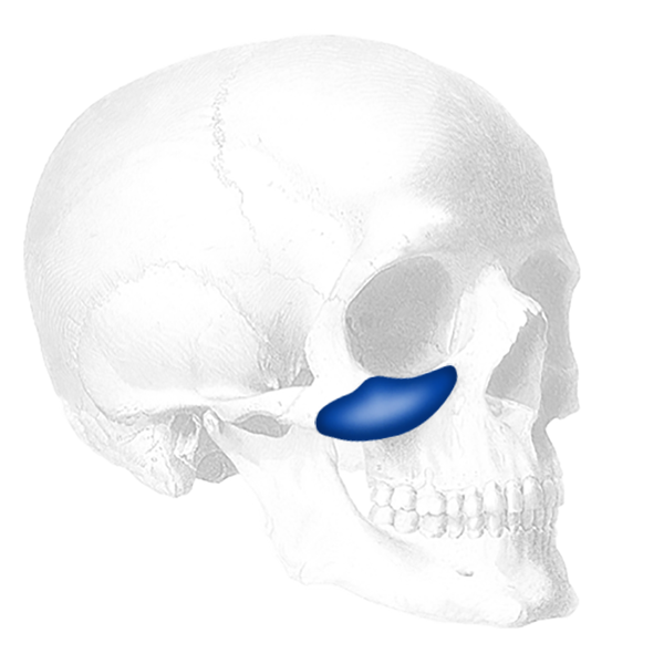 Implantech Extended Flowers Tear Trough® Facial Implant (Sold in Pairs)