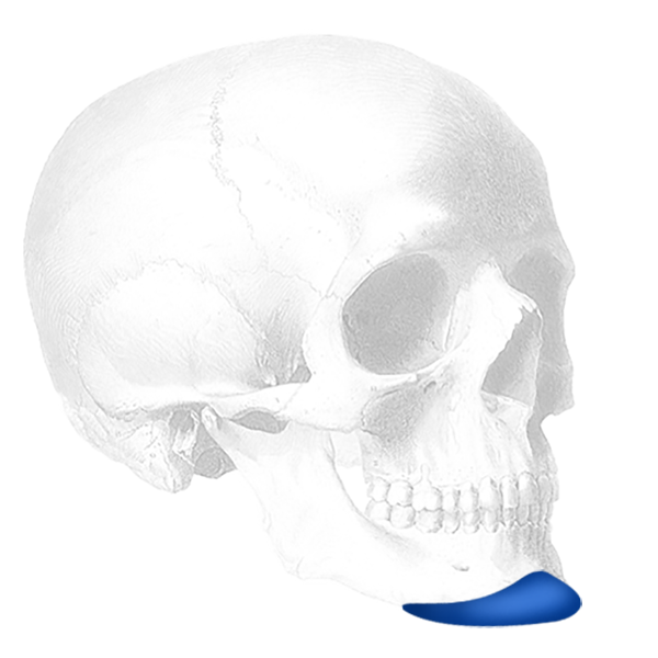 Implantech Flowers Mandibular Glove® Implant