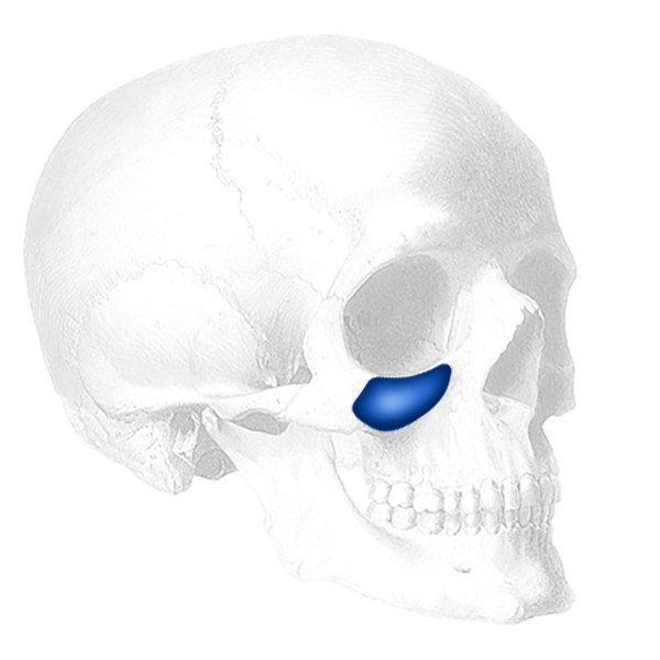 Implantech Flowers Tear Trough® Facial Implant (Sold in Pairs)