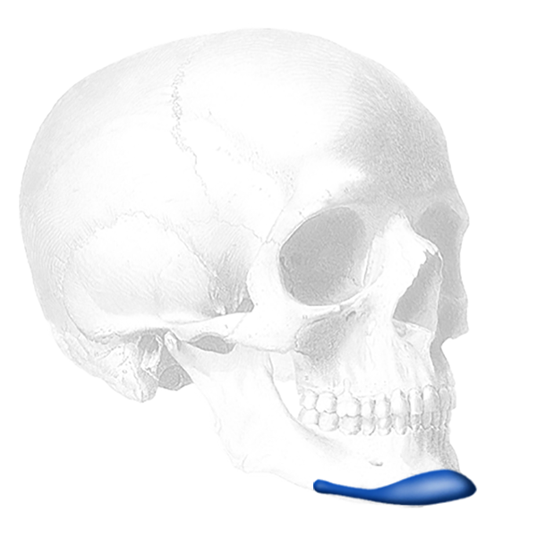 Implantech Terino Extended Anatomical™ Chin Implant