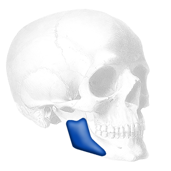 Implantech Posterior Mandibular Angle™ Implant