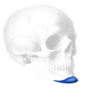 Implantech ePTFE-Coated Extended Anatomical Chin Implant