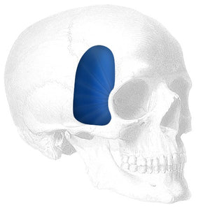Implantech Extended Temporal Shell Facial Implant