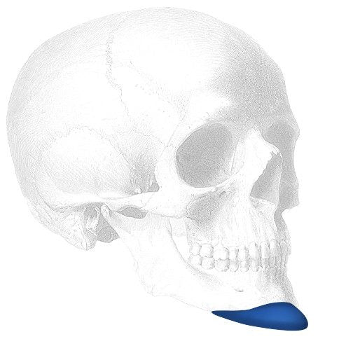 Implantech Vertical Lengthening Chin Implant