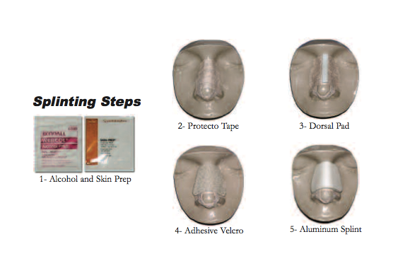 Denver Nasal Splint Kit - Two Piece Velcro - Box of 5 | Precise Medical