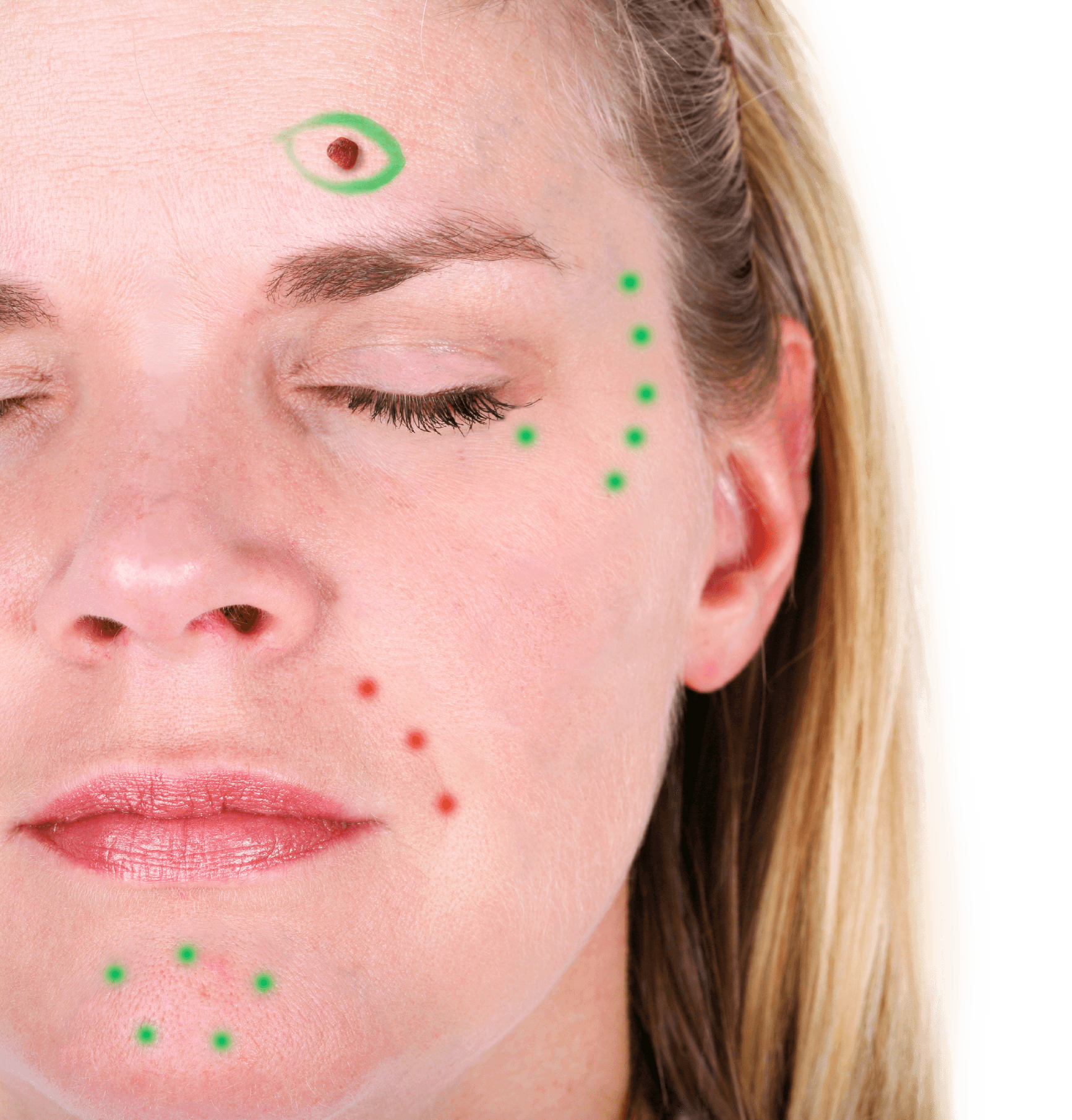 Viscot EZ Skin Marker Pens