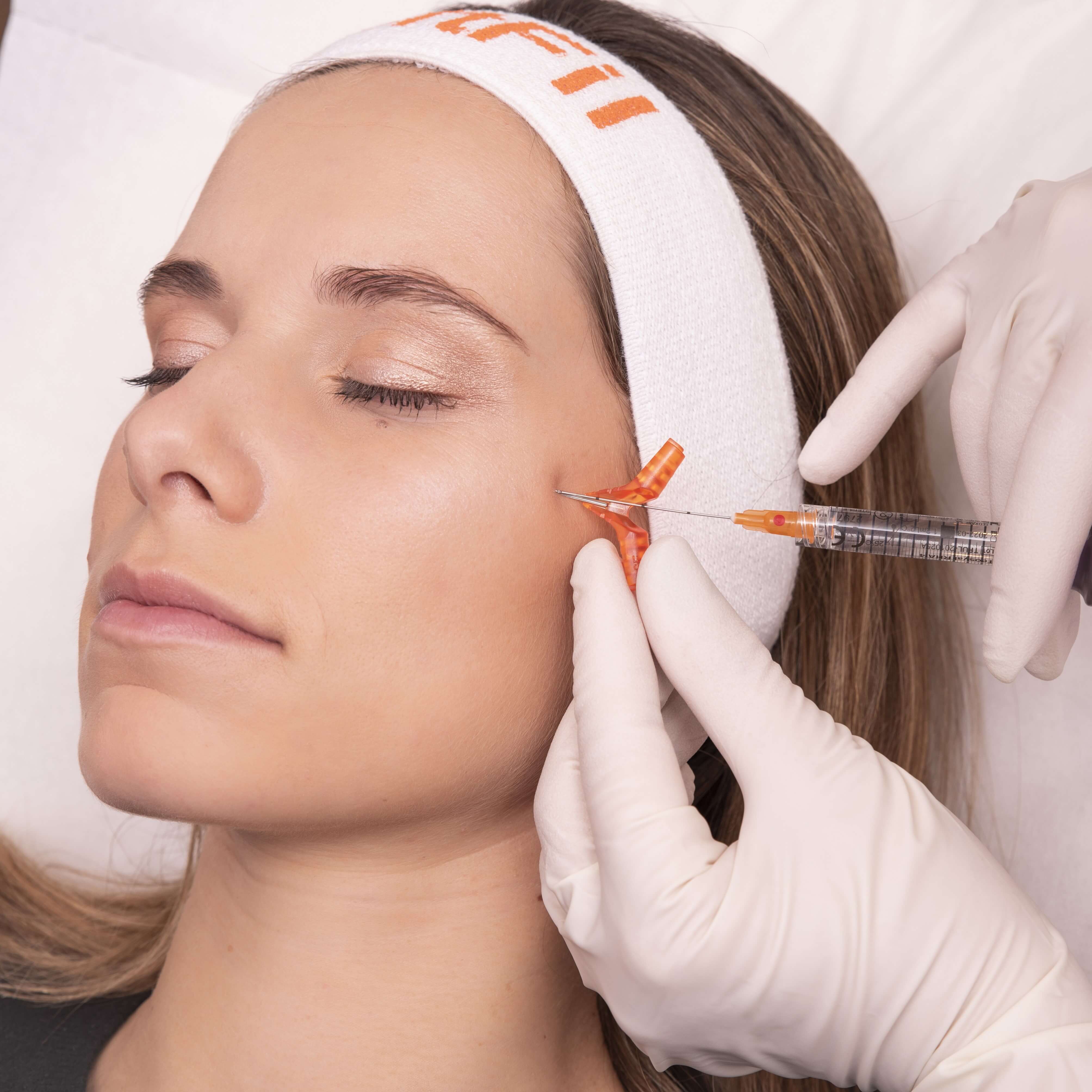 SoftFil EasyGuide Pre-Hole Needle & Micro-Cannula kit (Box Of 20)