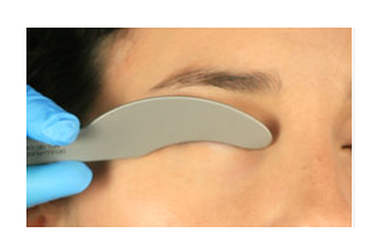 Oculo-Plastik Sutcliffe Laser Shield