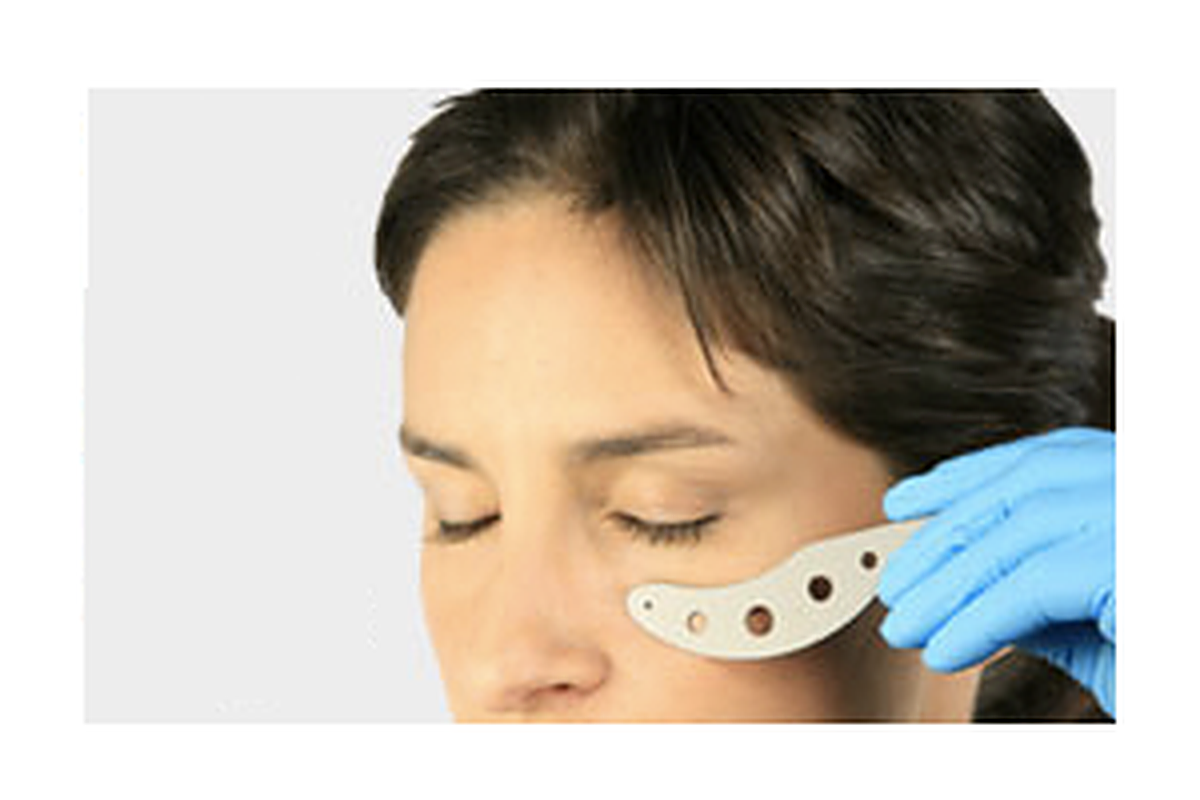 Oculo-Plastik Sutcliffe-Boey Laser Shield